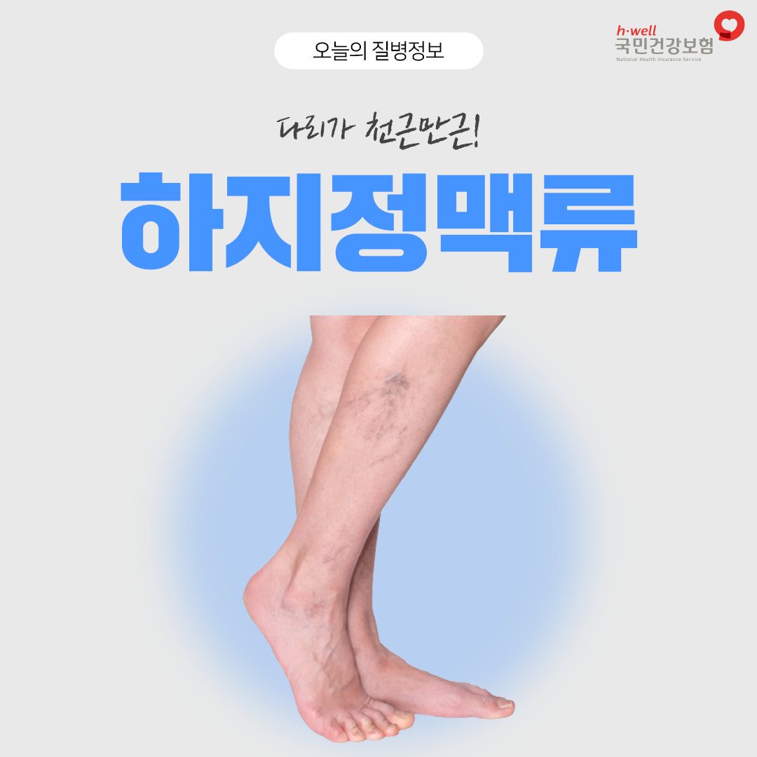 하지정맥류1.jpg